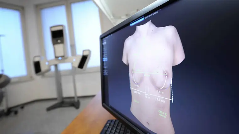 Vorschaubild zum Video über Brustimplantate und Größen